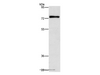 Western Blot analysis of Mouse brain tissue using PKC delta Polyclonal Antibody at dilution of 1:350