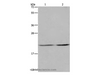 Western Blot analysis of A549 and Hela cell using ASF1A Polyclonal Antibody at dilution of 1:1200