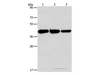 Western Blot analysis of Human normal liver tissue, Mouse brain and heart tissue using GOT1 Polyclonal Antibody at dilution of 1:1600