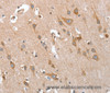 Immunohistochemistry of paraffin-embedded Human brain  using TP53BP2 Polyclonal Antibody at dilution of 1:35