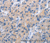 Immunohistochemistry of paraffin-embedded Human brain tissue using CD137 Polyclonal Antibody at dilution 1:50