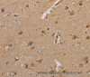 Immunohistochemistry of paraffin-embedded Human brain tissue using DLD Polyclonal Antibody at dilution 1:35