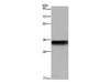 Western Blot analysis of Human placenta tissue using CD32 Polyclonal Antibody at dilution of 1:850