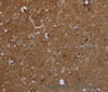 Immunohistochemistry of paraffin-embedded Human brain  using GALT Polyclonal Antibody at dilution of 1:30