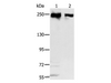 Western Blot analysis of Hela and 293T cell using MCM3AP Polyclonal Antibody at dilution of 1:350