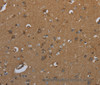 Immunohistochemistry of paraffin-embedded Human brain  tissue using ID2 Polyclonal Antibody at dilution 1:30