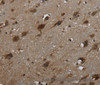 Immunohistochemistry of paraffin-embedded Human brain  tissue using GLIPR1 Polyclonal Antibody at dilution 1:50