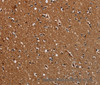Immunohistochemistry of paraffin-embedded Human brain  tissue using TICAM2 Polyclonal Antibody at dilution 1:60