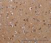 Immunohistochemistry of paraffin-embedded Human brain  tissue using KLHL1 Polyclonal Antibody at dilution 1:30