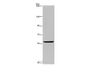 Western Blot analysis of Human fetal brain tissue using LBR Polyclonal Antibody at dilution of 1:300