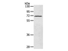 Western Blot analysis of Human fetal brain tissue using LTA4H Polyclonal Antibody at dilution of 1:500