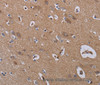 Immunohistochemistry of paraffin-embedded Human brain  using ZC3H12A Polyclonal Antibody at dilution of 1:40