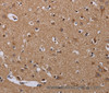 Immunohistochemistry of paraffin-embedded Human brain  using MCTS1 Polyclonal Antibody at dilution of 1:60