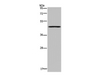 Western Blot analysis of Mouse lung tissue using MECP2 Polyclonal Antibody at dilution of 1:300