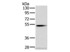 Western Blot analysis of Mouse pancreas tissue using PNLIP Polyclonal Antibody at dilution of 1:400