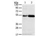 Western Blot analysis of Human placenta and stomach cancer tissue using SAMD3 Polyclonal Antibody at dilution of 1:400