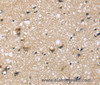 Immunohistochemistry of paraffin-embedded Human brain tissue using SEMA4A Polyclonal Antibody at dilution 1:45