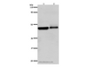 Western Blot analysis of Hela and A549 cell using ADRB2 Polyclonal Antibody at dilution of 1:600