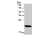 Western Blot analysis of Mouse heart tissue using RAB18 Polyclonal Antibody at dilution of 1:400