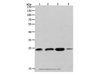 Western Blot analysis of K562, 231 and Hela cell, Human fetal brain tissue using RHOA Polyclonal Antibody at dilution of 1:400