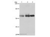 Western Blot analysis of Human cervical cancer, legs fibrous histiocytoma and fetal brain tissue using NECTIN1 Polyclonal Antibody at dilution of 1:400