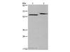 Western Blot analysis of Human fetal brain and Mouse brain tissue using EGR4 Polyclonal Antibody at dilution of 1:400