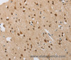 Immunohistochemistry of paraffin-embedded Human brain  tissue using FASLG Polyclonal Antibody at dilution 1:30