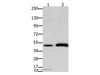 Western Blot analysis of Mouse brain and  heart tissue using FOXL2 Polyclonal Antibody at dilution of 1:750