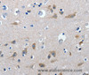 Immunohistochemistry of paraffin-embedded Human brain  tissue using GAD2  Polyclonal Antibody at dilution 1:30