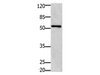 Western Blot analysis of 293T cell using GFRA1 Polyclonal Antibody at dilution of 1:1250