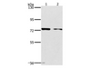 Western Blot analysis of MCF7 and hela cell using PPP1R13L Polyclonal Antibody at dilution of 1:500