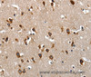 Immunohistochemistry of paraffin-embedded Human brain tissue using LAMA1 Polyclonal Antibody at dilution of 1:70
