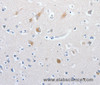 Immunohistochemistry of paraffin-embedded Human brain tissue using MATN1 Polyclonal Antibody at dilution 1:60