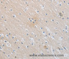 Immunohistochemistry of paraffin-embedded Human brain  using SLC16A7 Polyclonal Antibody at dilution of 1:30