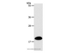 Western Blot analysis of Mouse heart tissue using SIRT5 Polyclonal Antibody at dilution of 1:500