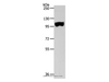 Western Blot analysis of Human colon tissue using SPAG1 Polyclonal Antibody at dilution of 1:600