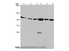 Western Blot analysis of Human testis tissue, K562, A549, Raji, NIH/3T3 and Hela cell using PRKD3 Polyclonal Antibody at dilution of 1:200