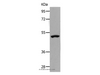 Western Blot analysis of Human lymphoma tissue using NDRG1 Polyclonal Antibody at dilution of 1:1000