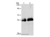 Western Blot analysis of Human colon tissue and Human ovarian cancer tissue using SLC5A5 Polyclonal Antibody at dilution of 1:950