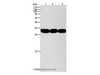 Western Blot analysis of Mouse liver and kidney tissue, RAW264.7 cell using NIT2 Polyclonal Antibody at dilution of 1:950