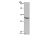 Western Blot analysis of Hela cell using NQO1 Polyclonal Antibody at dilution of 1:600