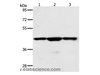 Western Blot analysis of Jurkat, hela and K562 cell using MAP2K1 Polyclonal Antibody at dilution of 1:400
