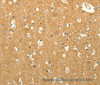 Immunohistochemistry of paraffin-embedded Human brain tissue using EDG7 Polyclonal Antibody at dilution 1:40