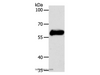 Western Blot analysis of MCF7 cell using CK-10 Polyclonal Antibody at dilution of 1:750