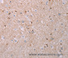 Immunohistochemistry of paraffin-embedded Human brain tissue using AKT2 Polyclonal Antibody at dilution 1:70