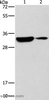 Western Blot analysis of Mouse heart and brain tissue using DSCR1 Polyclonal Antibody at dilution of 1:500