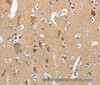 Immunohistochemistry of paraffin-embedded Human brain  using DSCR1 Polyclonal Antibody at dilution of 1:45