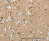 Immunohistochemistry of paraffin-embedded Human brain  tissue using PITX3 Polyclonal Antibody at dilution 1:40