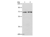 Western Blot analysis of Human liver cancer and colon cancer tissue using STK39 Polyclonal Antibody at dilution of 1:800