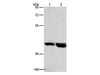 Western Blot analysis of Mouse heart and liver tissue using GPR182 Polyclonal Antibody at dilution of 1:1000